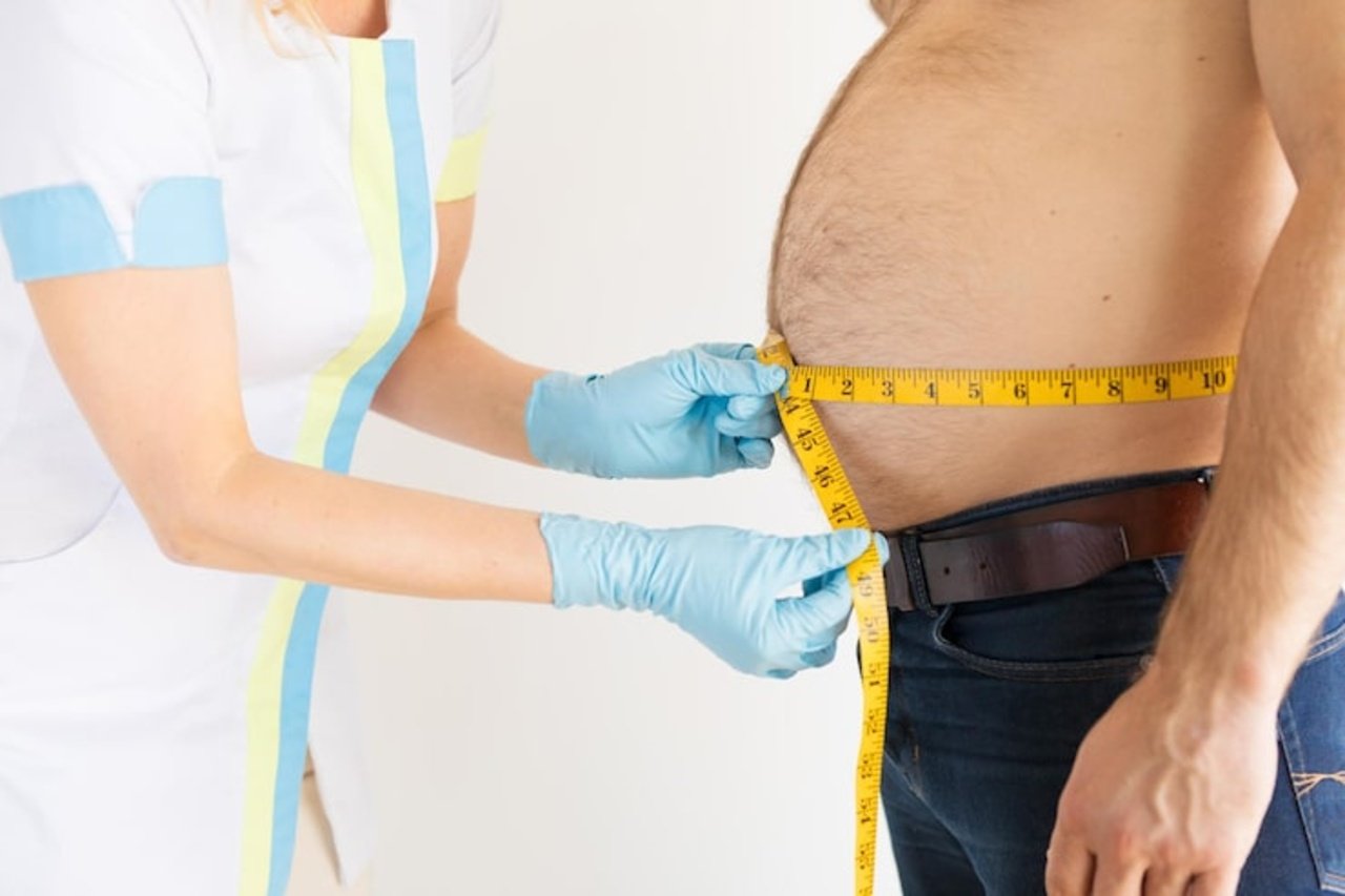 Bariatric (Obesity) Surgery