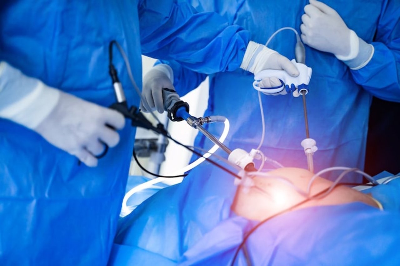 Laproscopic Surgery